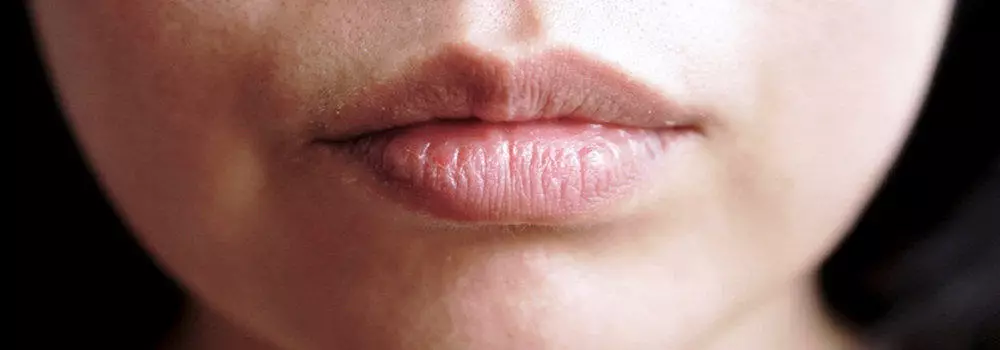Lip Plumper