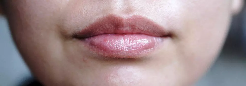 Lip Plumper